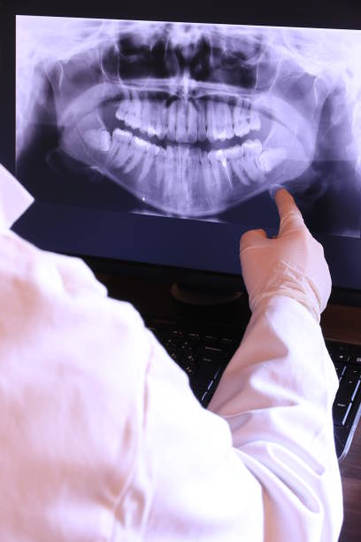 Best Emergency Treatment for Dental Infections or Abscesses in Dundalk, MD
